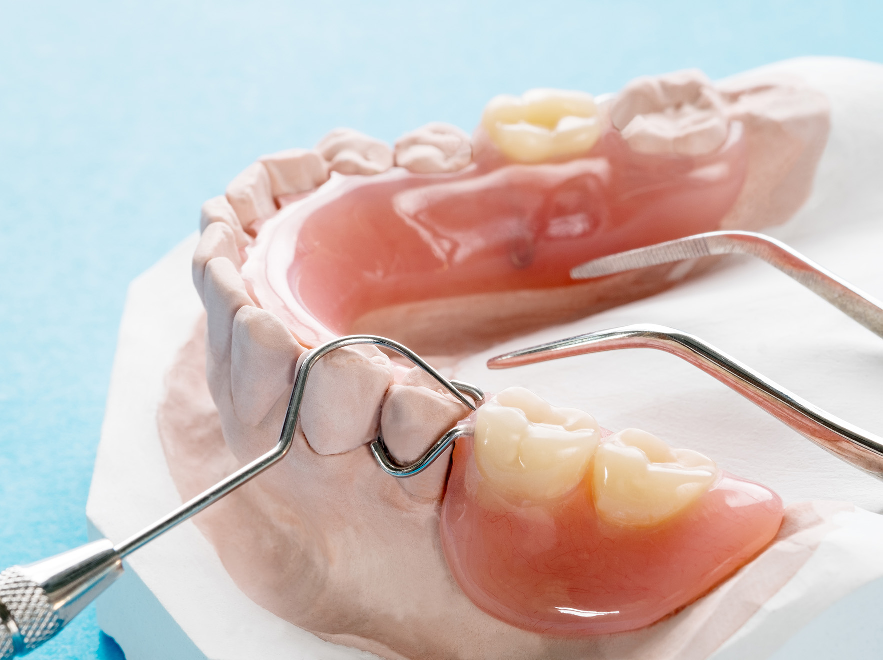 Partial dentures